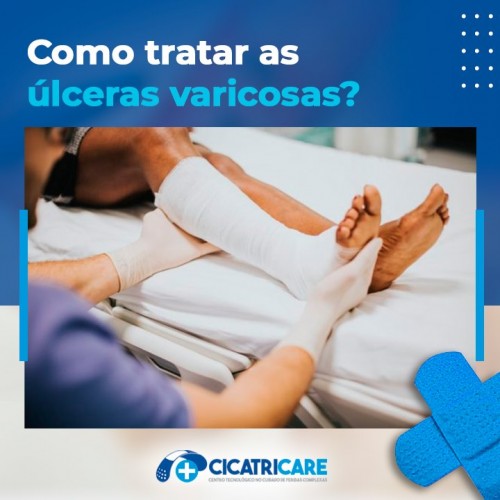 Como tratar as úlceras varicosas?