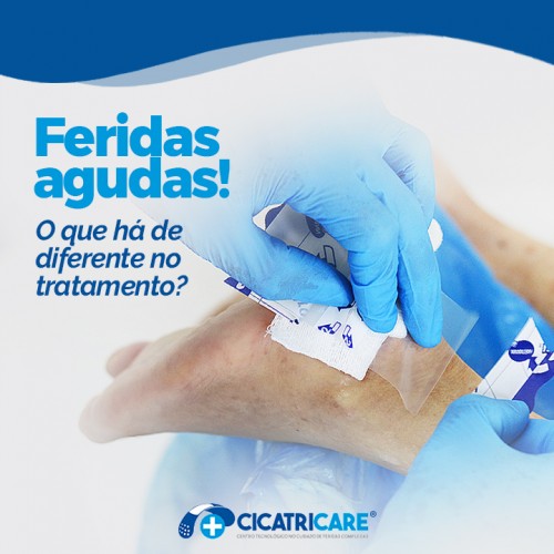 Feridas agudas! O que há de diferente no tratamento?