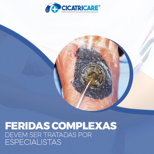 Feridas complexas devem ser tratadas por especialistas