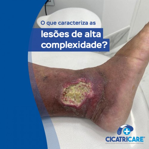 O que caracteriza as lesões de alta complexidade?