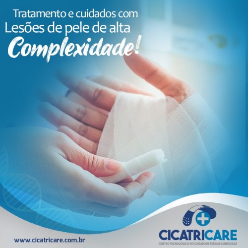 Tratamento e cuidados com lesões de pele de alta complexidade.