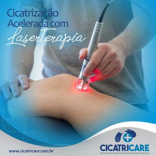 Cicatrização Acelerada com Laserterapia