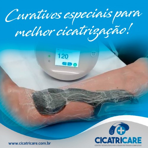 Curativos especiais para melhor cicatrização!