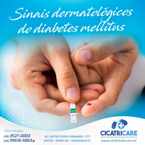 Sinais dermatológicos do diabetes mellitus